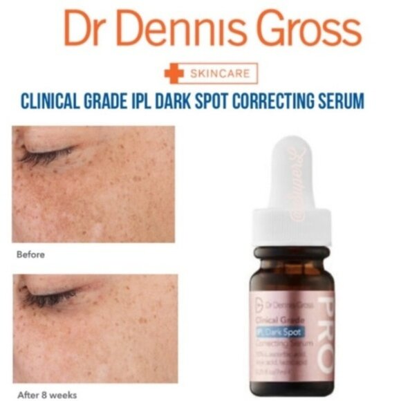 💖NEW!💖Dr. Dennis Gross Clinical Grade IPL Dark Spot Correcting Serum - Picture 1 of 3